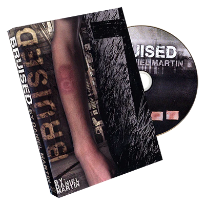 Bruised by Daniel Martin